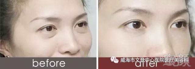 https://img.miyanlife.com/mnt/timg/180721/10441LA0-0.jpg