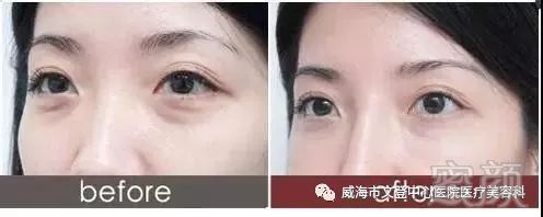 https://img.miyanlife.com/mnt/timg/180721/10441U604-1.jpg