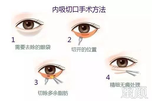 https://img.miyanlife.com/mnt/timg/180721/1044202940-4.jpg
