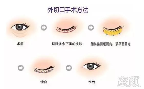https://img.miyanlife.com/mnt/timg/180721/1044212D9-5.jpg