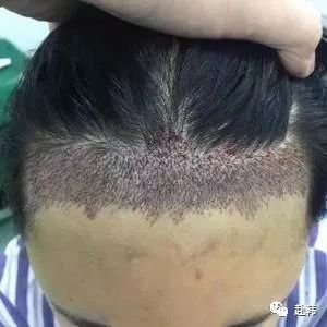 https://img.miyanlife.com/mnt/timg/180721/1046495643-1.jpg