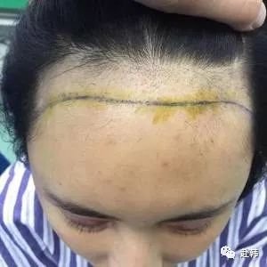 https://img.miyanlife.com/mnt/timg/180721/10464W921-0.jpg