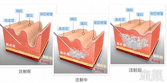 案例图片