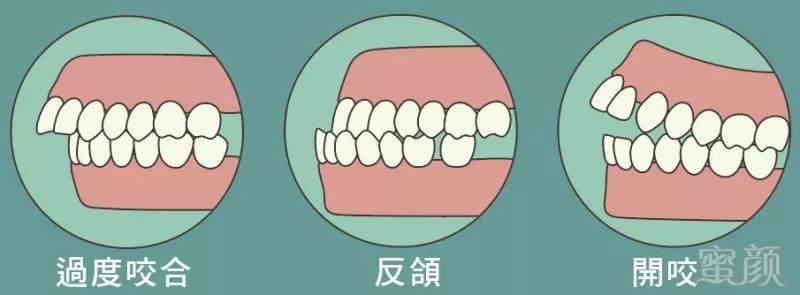 https://img.miyanlife.com/mnt/timg/180721/1101015245-8.jpg