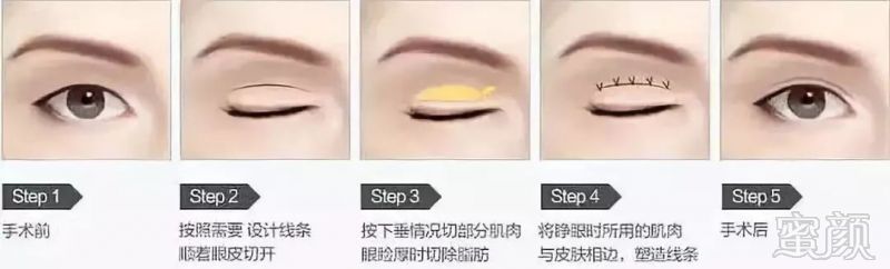 https://img.miyanlife.com/mnt/timg/180721/110J42261-8.jpg