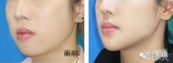 https://img.miyanlife.com/mnt/timg/180721/110S320c-0.jpg