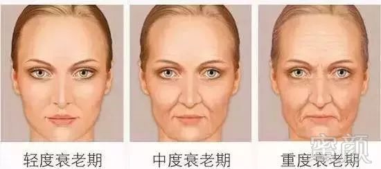 https://img.miyanlife.com/mnt/timg/180721/1114542019-0.jpg