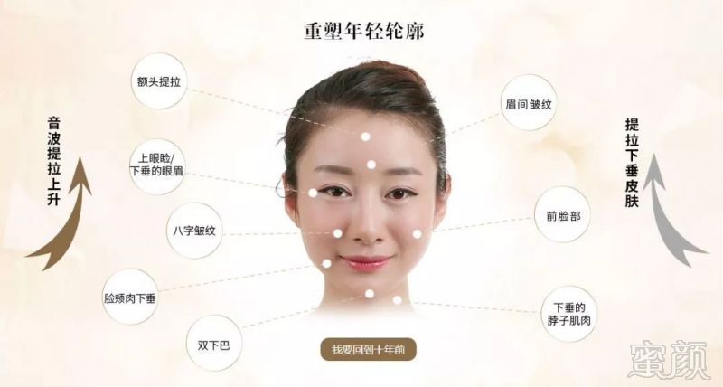 https://img.miyanlife.com/mnt/timg/180721/1114551106-3.jpg