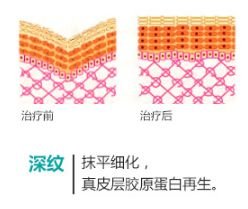 https://img.miyanlife.com/mnt/timg/180721/1114562H7-8.jpg