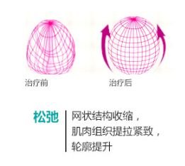 https://img.miyanlife.com/mnt/timg/180721/11145BX2-9.jpg
