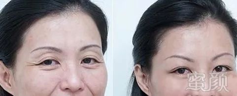 https://img.miyanlife.com/mnt/timg/180721/1150443M7-9.jpg