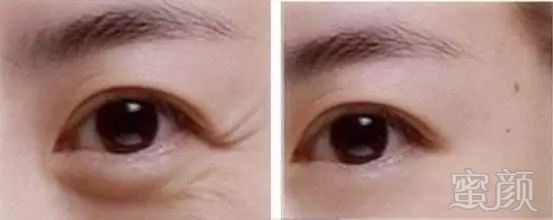 https://img.miyanlife.com/mnt/timg/180721/1150451M6-11.jpg