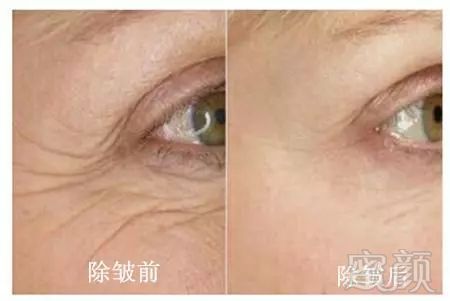 https://img.miyanlife.com/mnt/timg/180721/1150452331-10.jpg