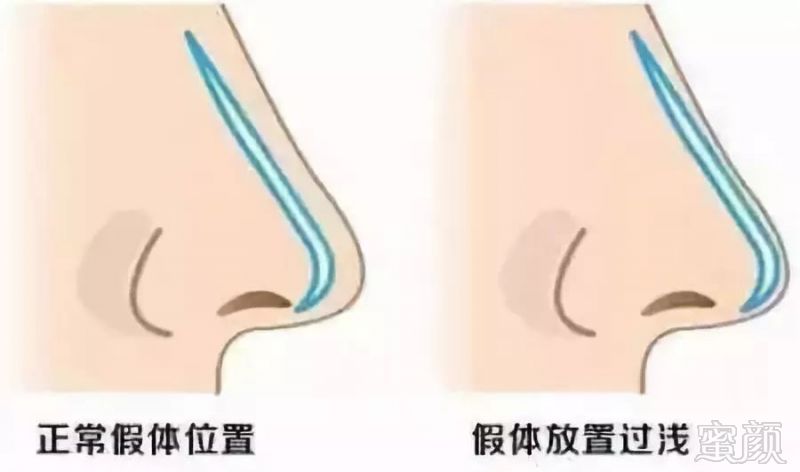 https://img.miyanlife.com/mnt/timg/180721/1153061440-2.jpg