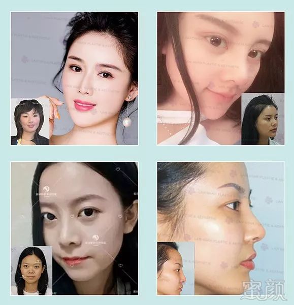 https://img.miyanlife.com/mnt/timg/180721/11530GB7-4.jpg