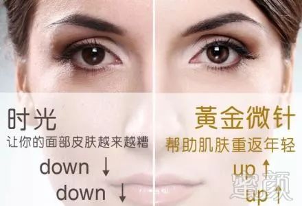 https://img.miyanlife.com/mnt/timg/180721/1159294Z0-11.jpg