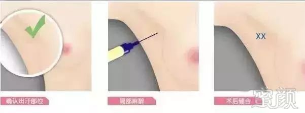https://img.miyanlife.com/mnt/timg/180721/11592U391-5.jpg