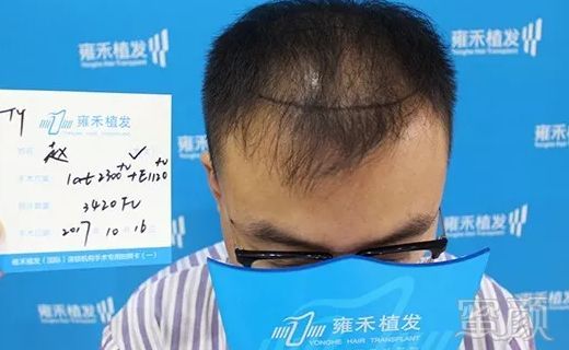 https://img.miyanlife.com/mnt/timg/180721/1212155M4-0.jpg