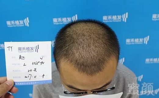https://img.miyanlife.com/mnt/timg/180721/1212193209-7.jpg