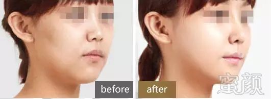 https://img.miyanlife.com/mnt/timg/180721/121F310P-10.jpg