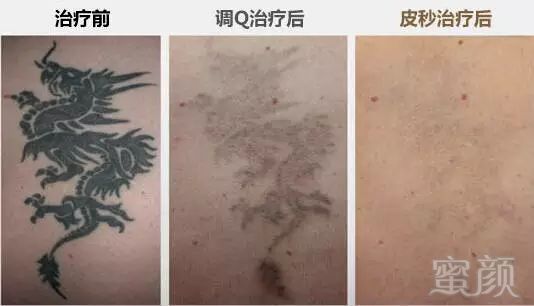 https://img.miyanlife.com/mnt/timg/180721/121F33I9-13.jpg