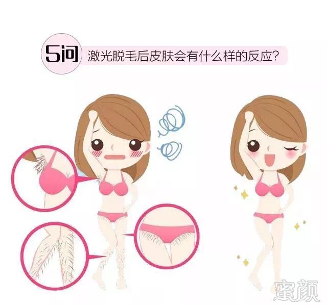 https://img.miyanlife.com/mnt/timg/180721/121K050F-5.jpg