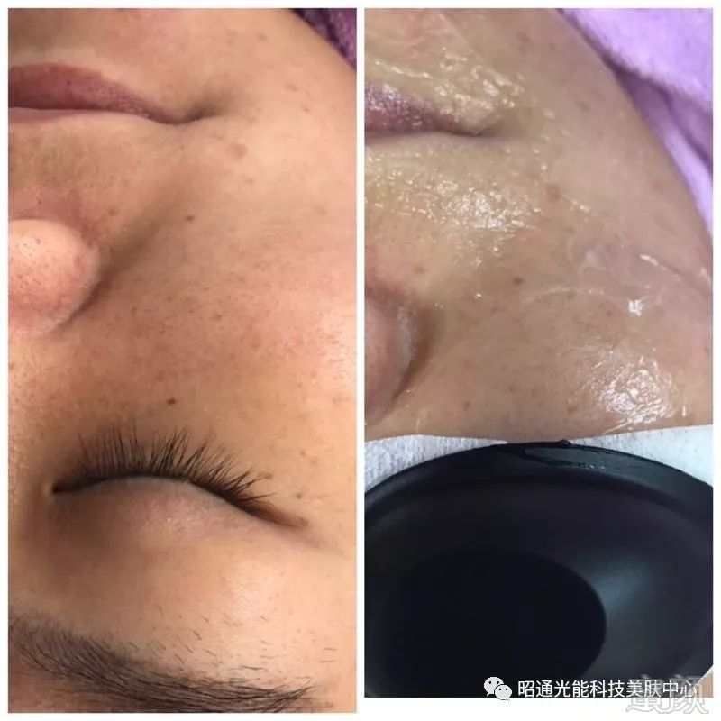 https://img.miyanlife.com/mnt/timg/180721/1222524459-5.jpg
