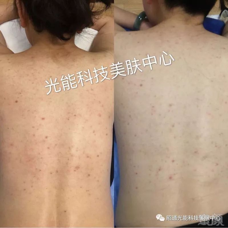 https://img.miyanlife.com/mnt/timg/180721/1222525455-3.jpg