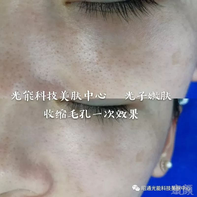 https://img.miyanlife.com/mnt/timg/180721/1222525502-6.jpg