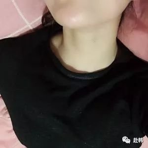 案例图片