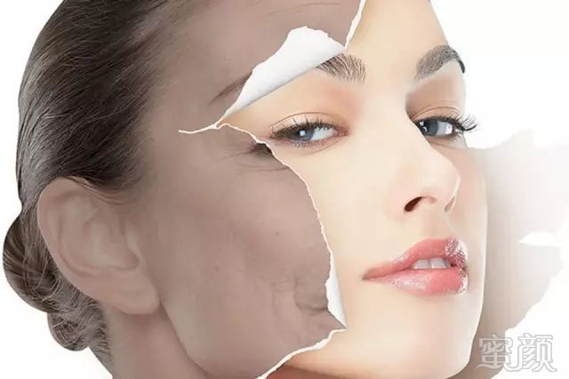 https://img.miyanlife.com/mnt/timg/180722/10441GA8-1.jpg