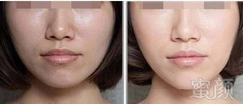 https://img.miyanlife.com/mnt/timg/180722/10441R044-2.jpg