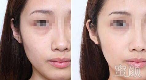 https://img.miyanlife.com/mnt/timg/180722/1044204Z6-3.jpg