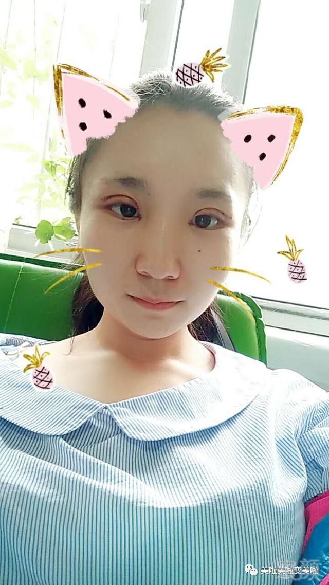 https://img.miyanlife.com/mnt/timg/180722/11141IX0-0.jpg