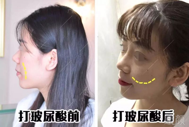 https://img.miyanlife.com/mnt/timg/180722/1132545214-7.jpg