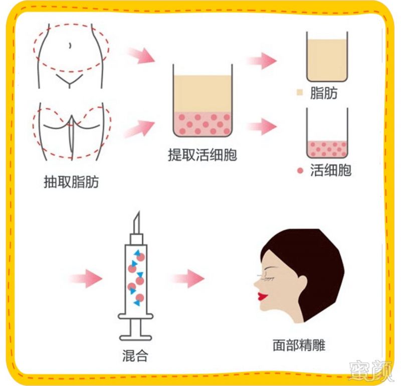 https://img.miyanlife.com/mnt/timg/180722/11325552L-9.jpg