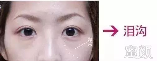 https://img.miyanlife.com/mnt/timg/180722/11342W321-5.jpg