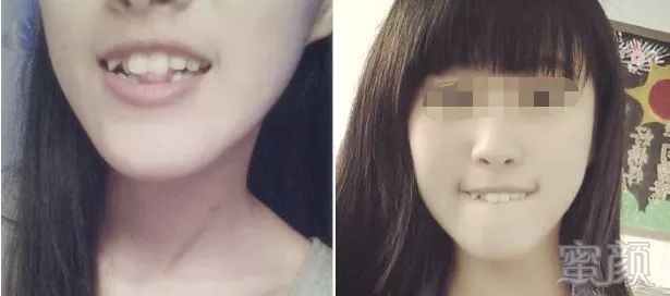 https://img.miyanlife.com/mnt/timg/180722/1135224E0-1.jpg