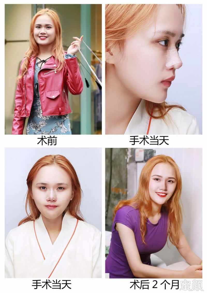https://img.miyanlife.com/mnt/timg/180722/12020JT5-4.jpg