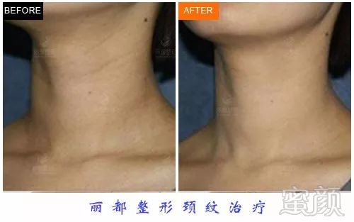 https://img.miyanlife.com/mnt/timg/180722/1231354Q6-7.jpg