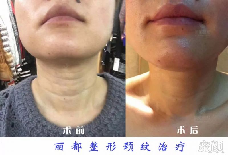 https://img.miyanlife.com/mnt/timg/180722/1231356334-6.jpg