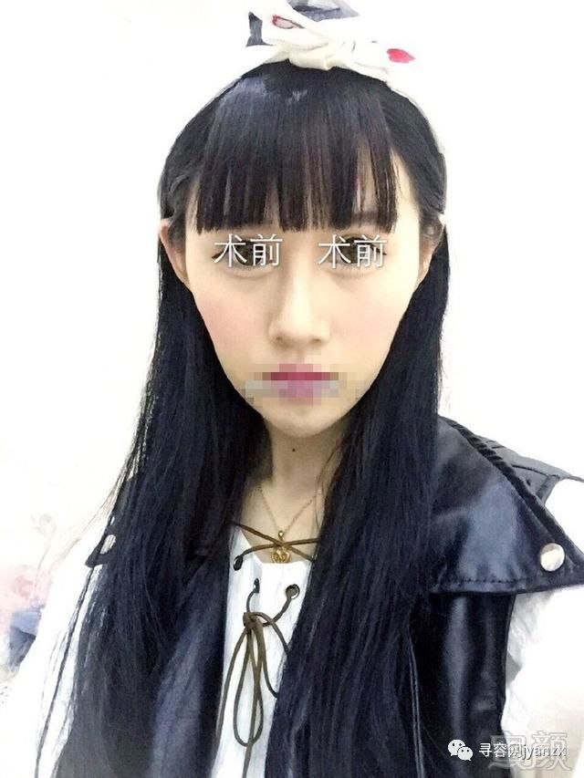 https://img.miyanlife.com/mnt/timg/180722/1232101461-0.jpg