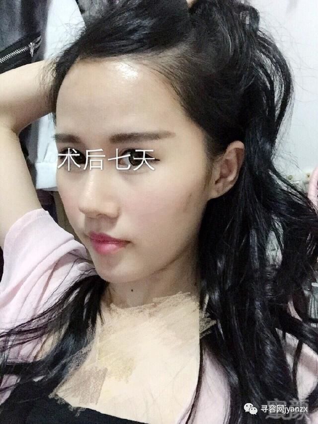 https://img.miyanlife.com/mnt/timg/180722/1232122211-2.jpg