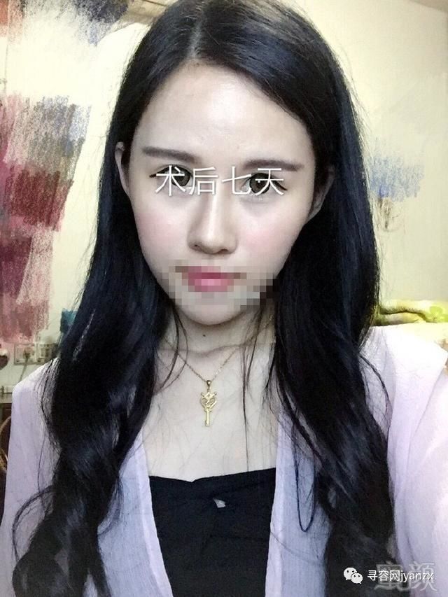 https://img.miyanlife.com/mnt/timg/180722/1232122236-4.jpg