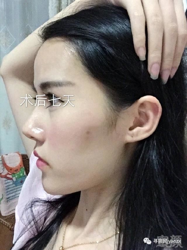 https://img.miyanlife.com/mnt/timg/180722/1232124555-3.jpg