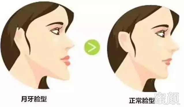 https://img.miyanlife.com/mnt/timg/180722/1233256054-2.jpg
