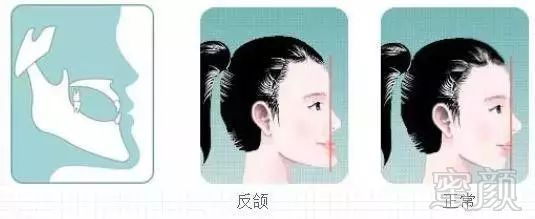 https://img.miyanlife.com/mnt/timg/180722/12332C3L-5.jpg