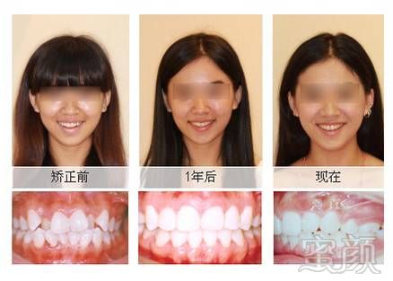 https://img.miyanlife.com/mnt/timg/180722/12332GB9-9.jpg