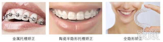 https://img.miyanlife.com/mnt/timg/180722/12332MC2-10.jpg