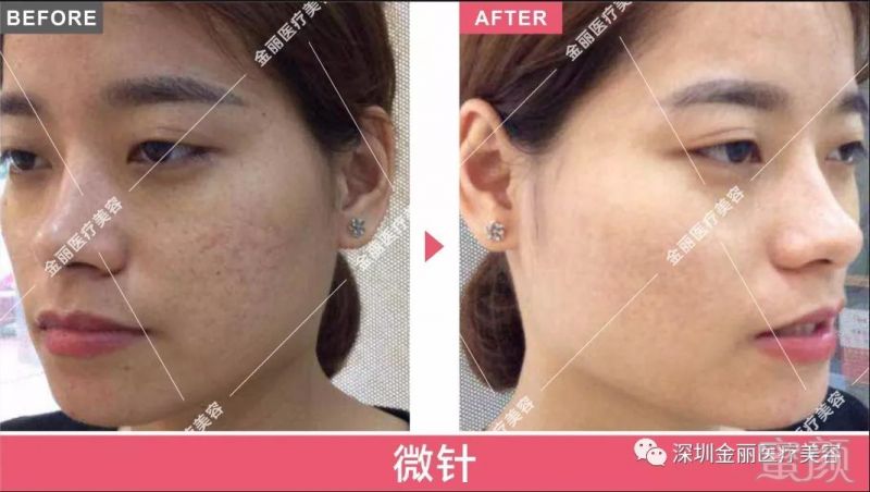 https://img.miyanlife.com/mnt/timg/180722/12343V554-4.jpg